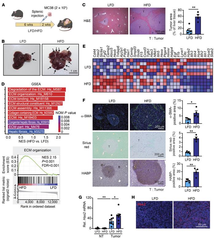 HFD-induced steatotic liver increases HA accumulation and HAS2 expressio...