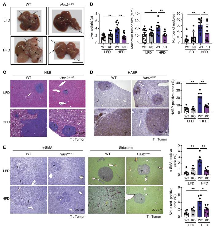 Suppression of metastatic liver tumor growth enhanced by metabolic dysfu...