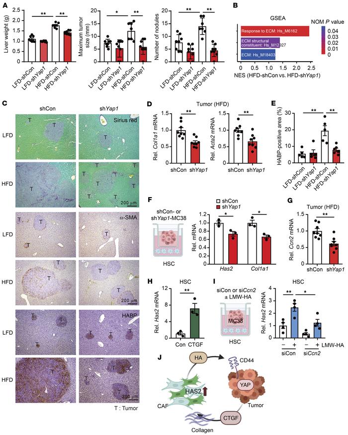 YAP knockdown attenuates CRC aggressiveness and CAF activation.
(A) Afte...