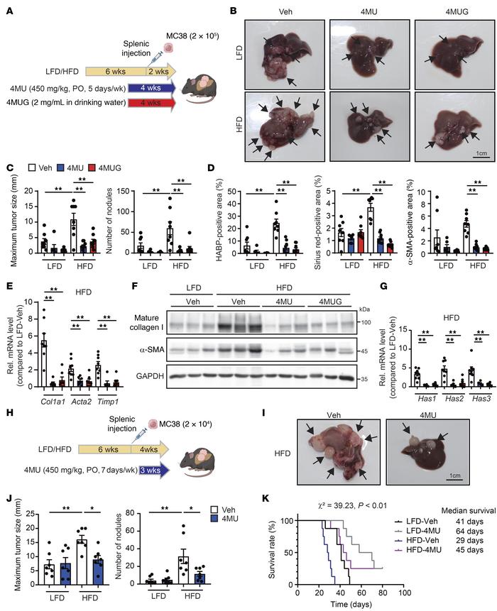 Inhibition of HA synthesis alleviates metastatic liver tumor growth and ...
