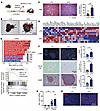 HFD-induced steatotic liver increases HA accumulation and HAS2 expression i