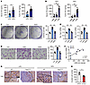 HAS2 and LMW-HA play an important role in cancer cell aggressiveness and YA