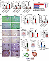 YAP knockdown attenuates CRC aggressiveness and CAF activation.