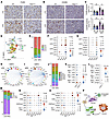 CAF-derived HAS2 and cancer-derived YAP contribute to a prometastatic immun