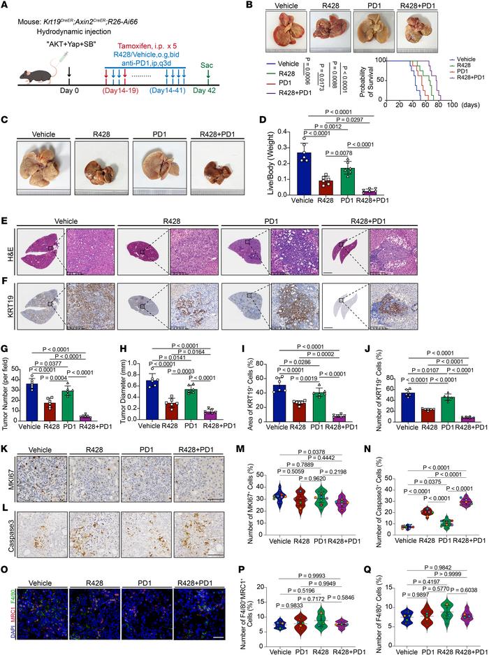 R428 treatment sensitizes murine ICC cells to anti–PD-1 treatment.
(A) E...