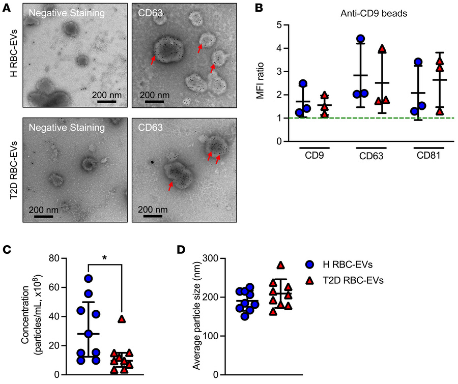 EVs are released by human RBCs.
Representative TEM images of EVs derived...