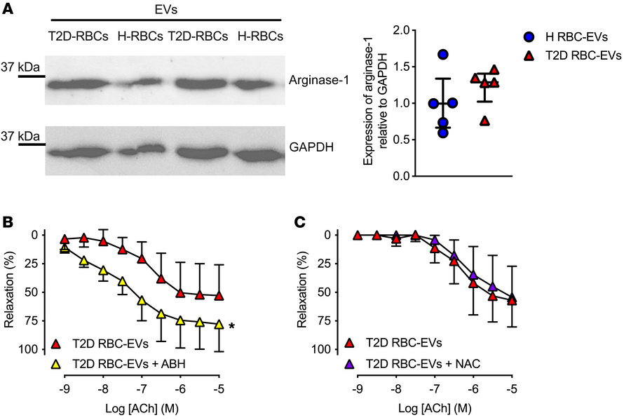 Arginase-1 is present in RBC-derived EVs and mediates endothelial dysfun...