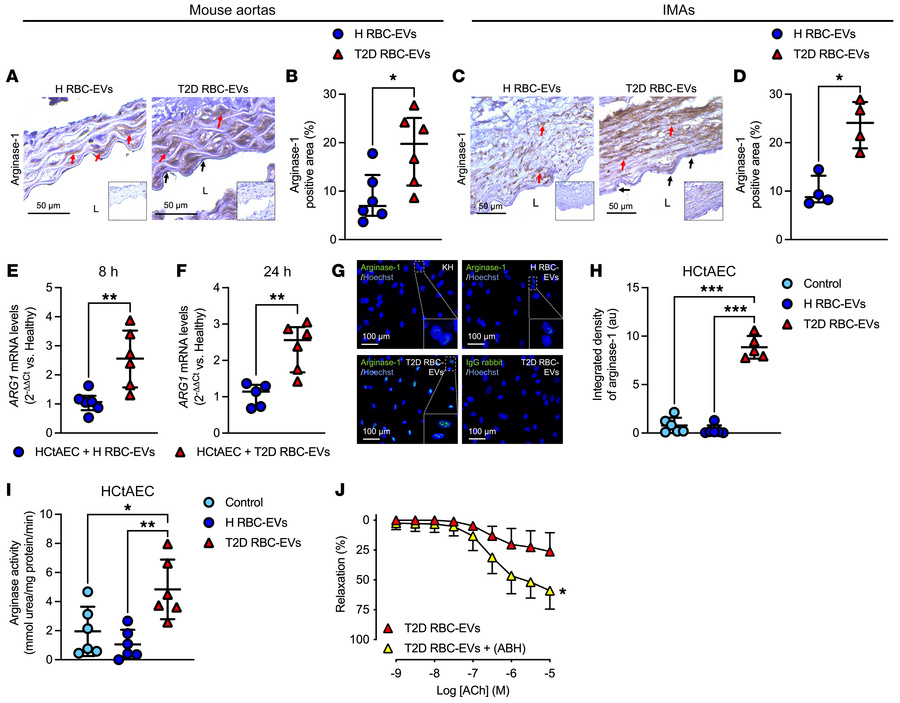 T2D RBC-EVs induce endothelial dysfunction through vascular arginase-1.
...
