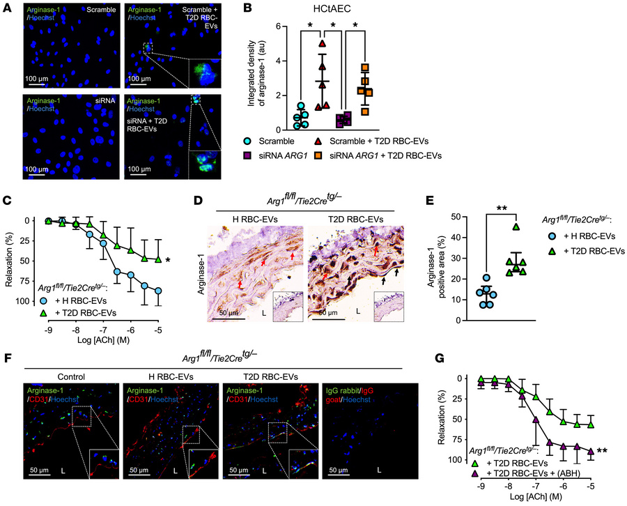 T2D RBC-EVs induce endothelial dysfunction through the transfer of argin...