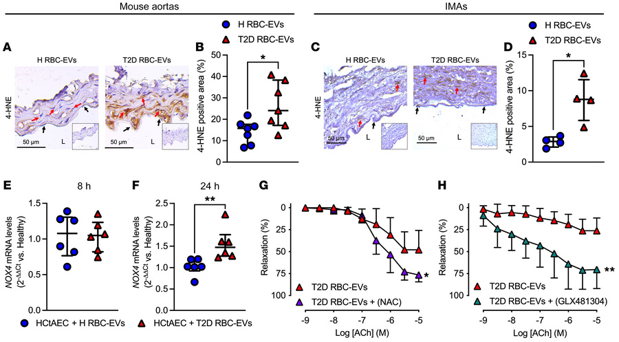 T2D RBC-EVs induce endothelial dysfunction through ROS.
Immunohistochemi...