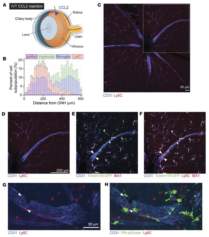 Perivascular macrophages correlate with Ly6C+ inflammatory cell infiltra...