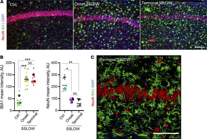 Reactive microglia in prion-infected mice extend into pyramidal layer of...