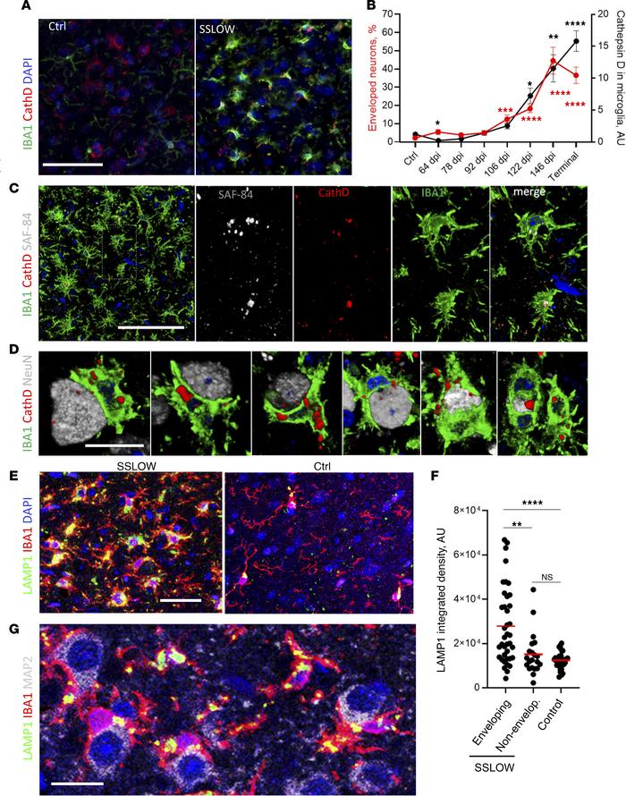 Microglia engaged in envelopment have activated hypertrophic lysosomes.
...