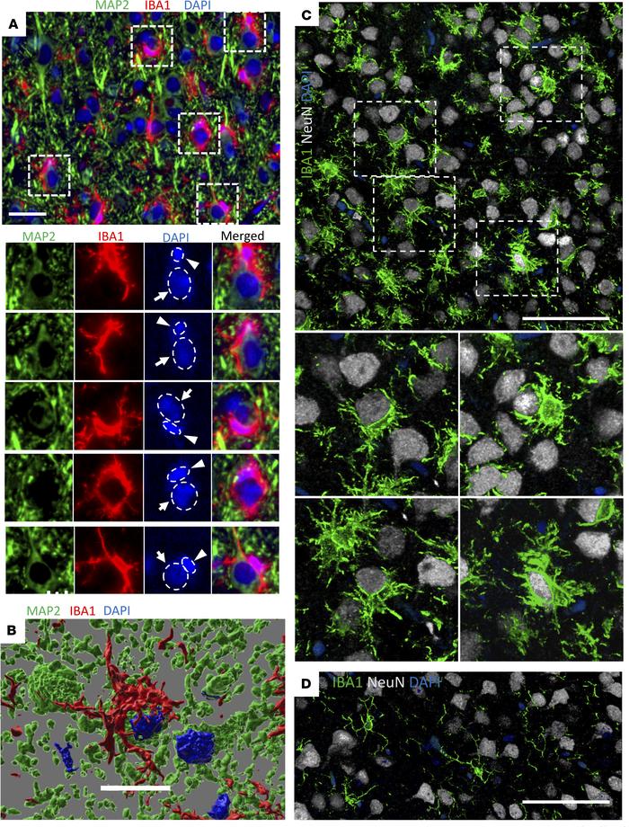 Reactive microglia in cortexes of prion-infected mice envelop neuronal s...