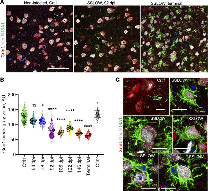 A decline in neuronal levels of Grin1 with disease progression.
(A) Conf...