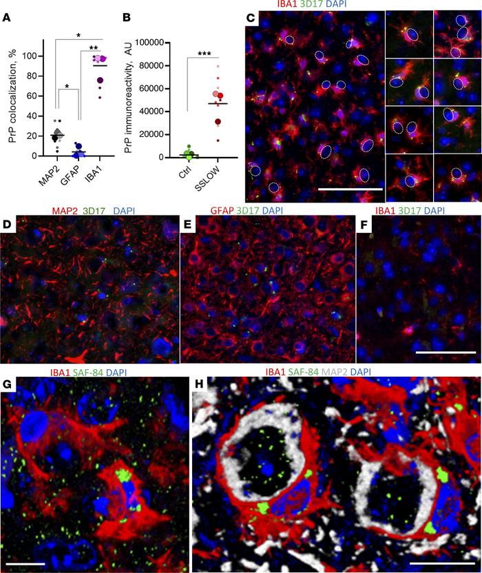 PrPSc colocalizes with reactive microglia.
(A) Quantification of PrPSc c...