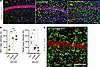 Reactive microglia in prion-infected mice extend into pyramidal layer of CA
