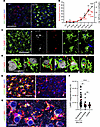 Microglia engaged in envelopment have activated hypertrophic lysosomes.