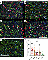 Envelopment of neurons is a common property among prion strains.