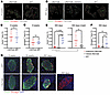 Disease modulation is secondary to preservation of β cells in the islets.