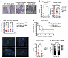 Protection from autoimmunity in βST mice is localized to the islet and peri