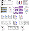 F. nucleatum and E. coli mediate immunosuppressive microenvironment in CRC.