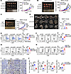 Knockdown CXCL3 inhibits tumor growth by preventing PMN-MDSC accumulation a