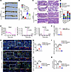 4-HPA correlates with PMN-MDSC accumulation in CRC.