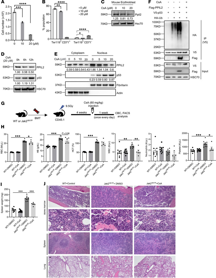 Inhibition of Ppil2 blocks erythropoiesis in vitro and ameliorates MPN s...