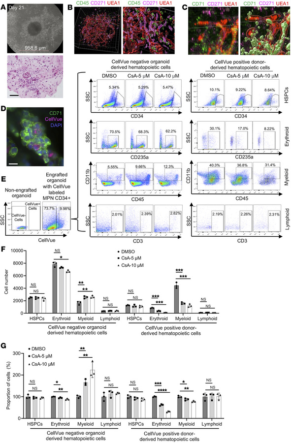 JAK2V617F-mutated MPN patient bone marrow cells engrafted in a bone marr...