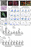 JAK2V617F-mutated MPN patient bone marrow cells engrafted in a bone marrow