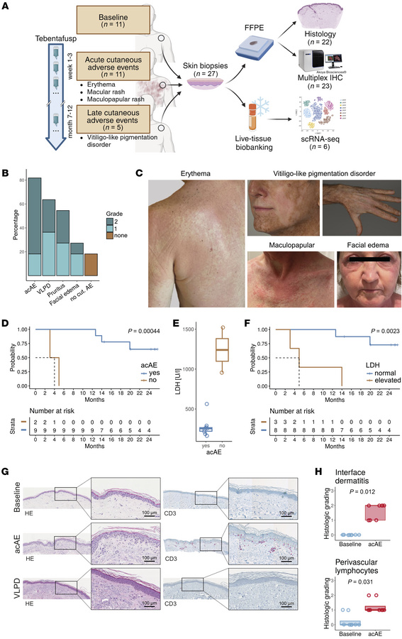 Study overview and characterization of clinical cohort.
(A) Overview of ...