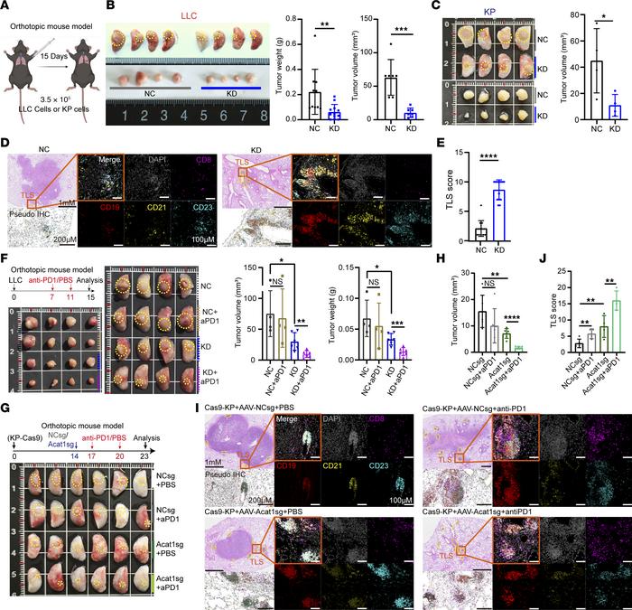 
Acat1 knockdown in lung carcinoma cells improves tertiary lymphoid stru...