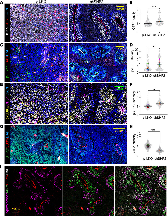 Characterization of SHP2-silenced B16F10 tumor architecture.
(A and B) K...