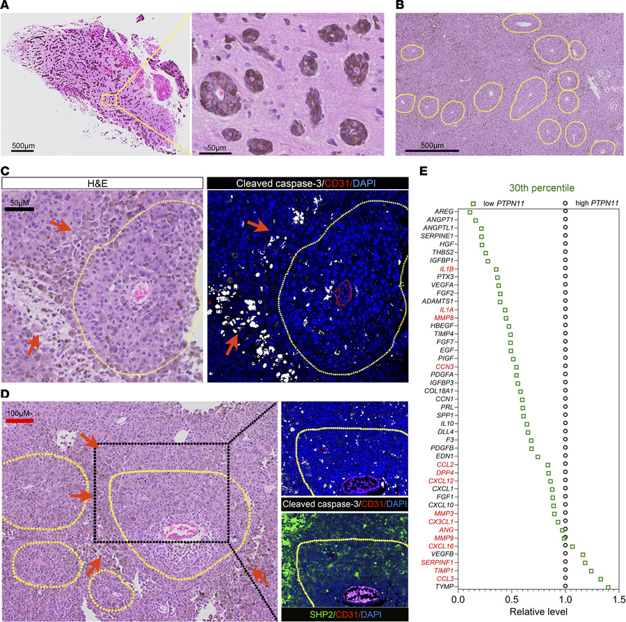 Relevance of SHP2-silenced B16F10 mouse tumor model to human melanoma.
(...