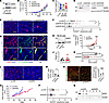 SHP2 depletion in B16F10 cells reduces tumor neovascularization.