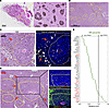 Relevance of SHP2-silenced B16F10 mouse tumor model to human melanoma.