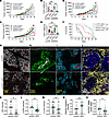 Contribution of SHP2 depletion to the antitumor activity of the MEK inhibit