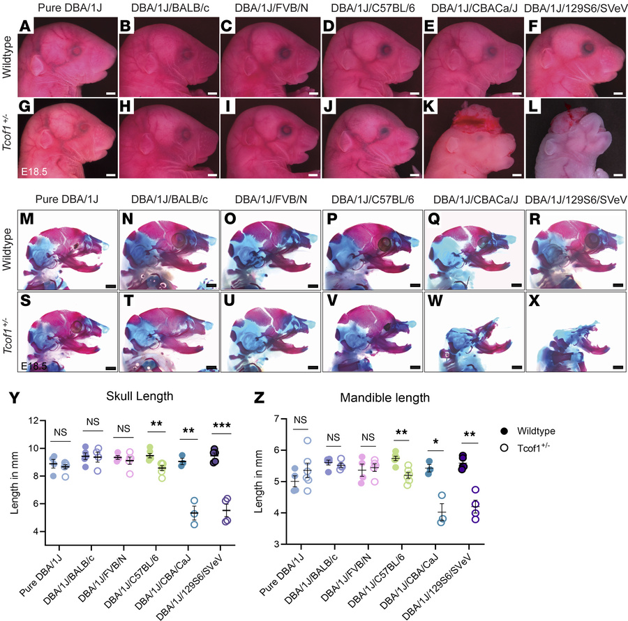 Identical Tcof1+/– alleles on different genetic backgrounds result in a ...