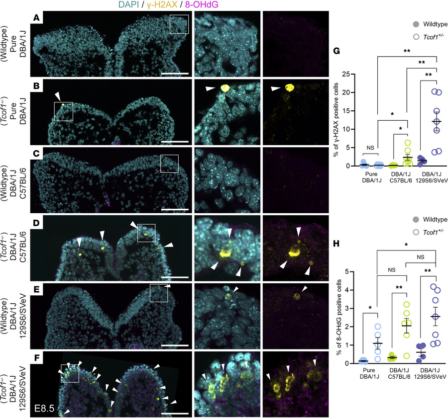 Identical Tcof1+/– alleles on different genetic backgrounds result in va...