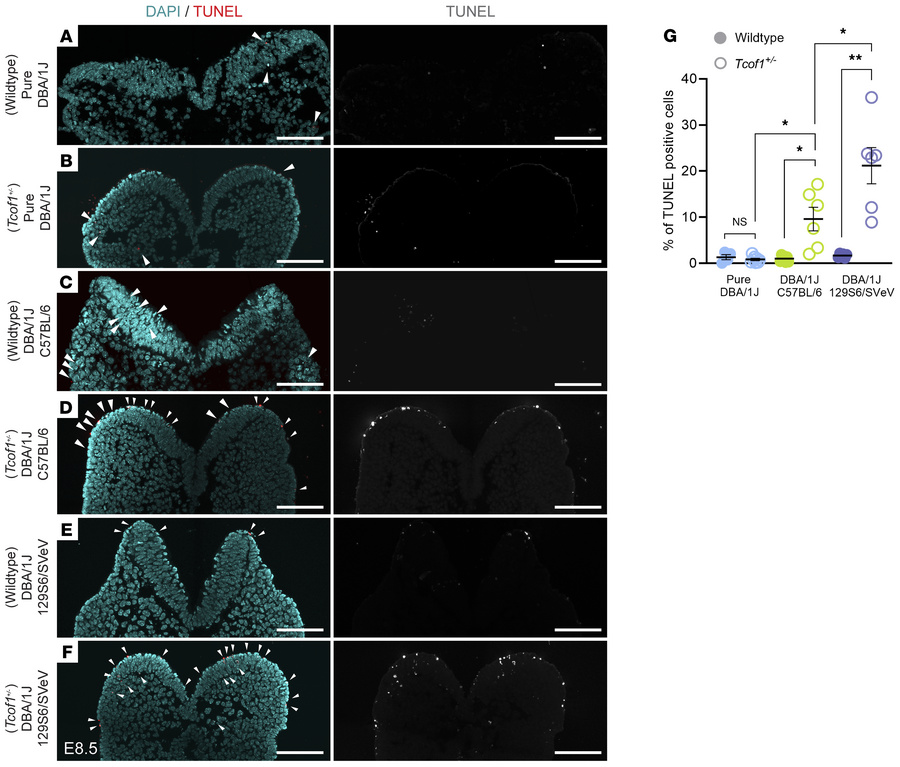 Identical Tcof1+/– alleles on different genetic backgrounds result in va...