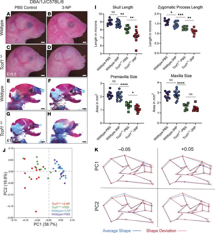 3-NP treatment exacerbates the TCS phenotype in embryos on a genetic bac...