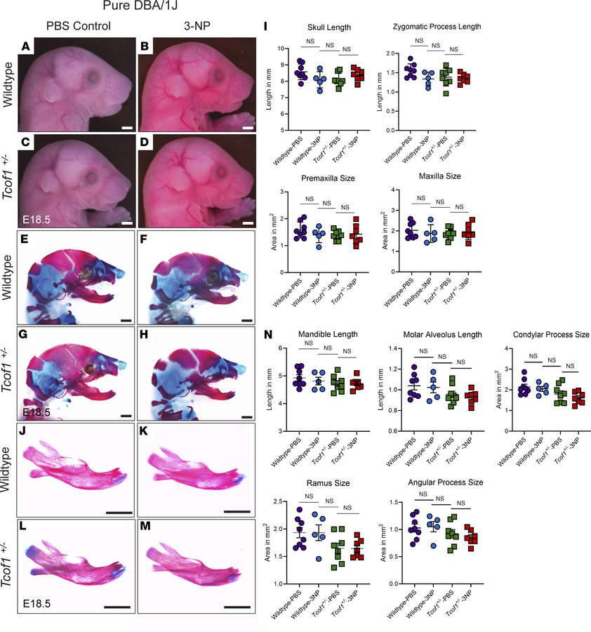 3-NP treatment alone is insufficient to change overall craniofacial shap...