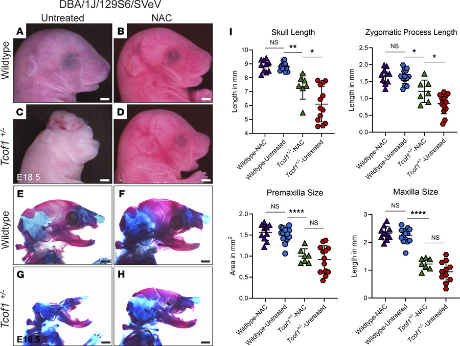 Reducing ROS via antioxidant supplementation partially rescues the TCS p...