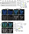 Endogenous levels of Tcof1/treacle protein and ROS vary depending on geneti