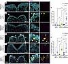 Identical Tcof1+/– alleles on different genetic backgrounds result in varyi