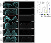 Identical Tcof1+/– alleles on different genetic backgrounds result in varyi