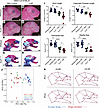 3-NP treatment exacerbates the TCS phenotype in embryos on a genetic backgr