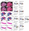 3-NP treatment alone is insufficient to change overall craniofacial shape a