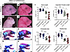 Reducing ROS via antioxidant supplementation partially rescues the TCS phen